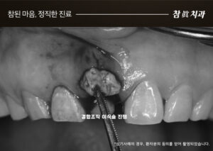 울산삼산동치과