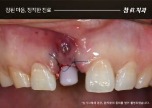 울산삼산동치과