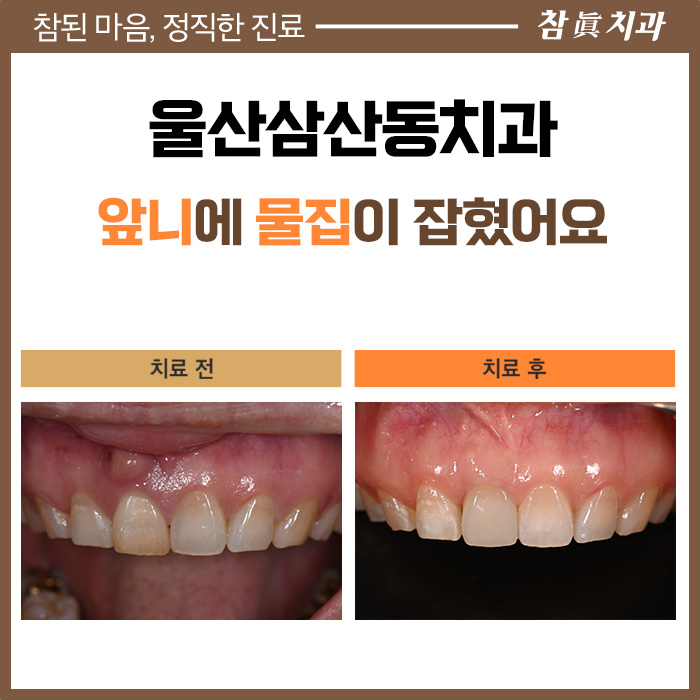 울산삼산동치과