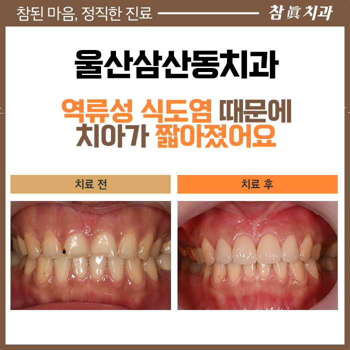 울산삼산동치과