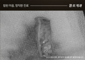 울산삼산동치과