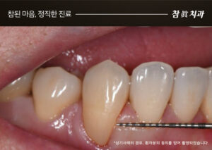 울산삼산동치과