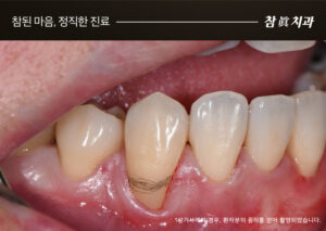 울산삼산동치과