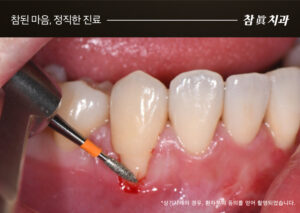 울산삼산동치과