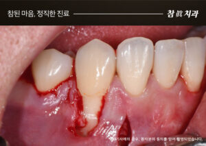 울산삼산동치과