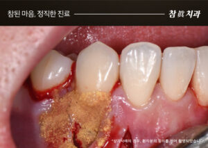 울산삼산동치과