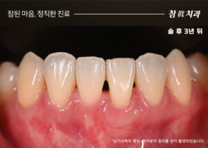 울산삼산동치과