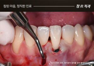 울산삼산동치과