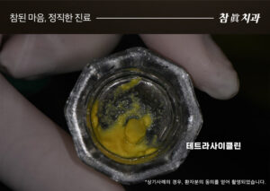 울산삼산동치과