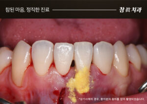 울산삼산동치과