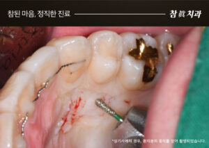 울산삼산동치과