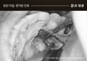 울산삼산동치과