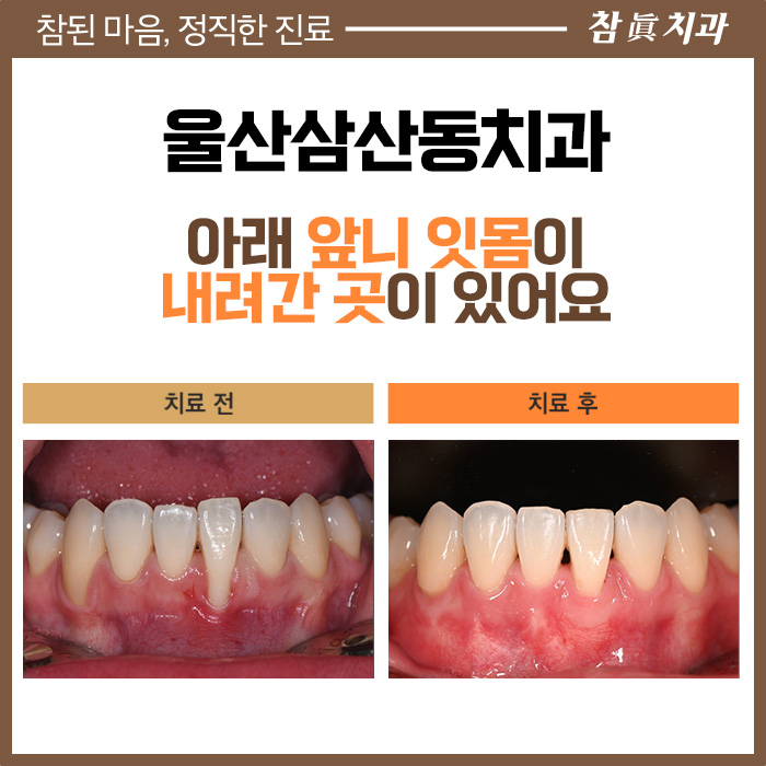 울산삼산동치과