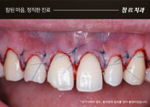 울산삼산동치과