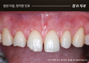 울산삼산동치과