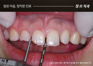 울산삼산동치과