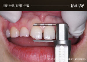 울산삼산동치과