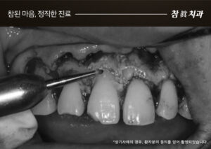 울산삼산동치과