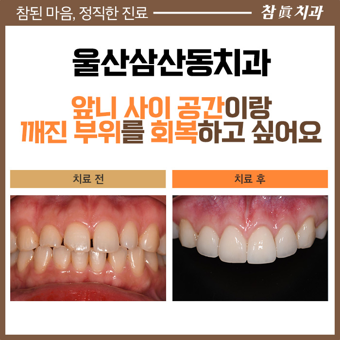 울산삼산동치과