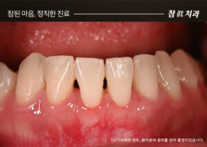 울산삼산동치과