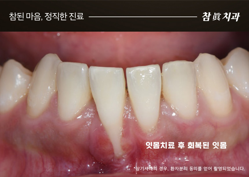 울산삼산동치과