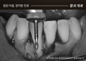 울산삼산동치과