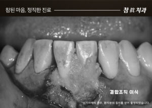 울산삼산동치과