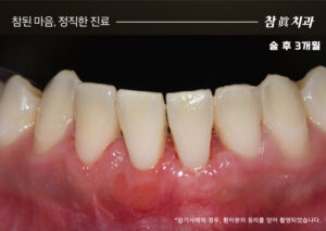 울산삼산동치과