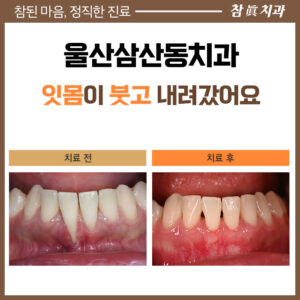울산삼산동치과