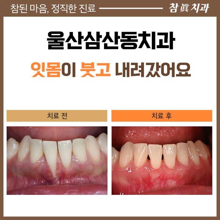 울산삼산동치과