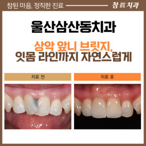 울산삼산동치과