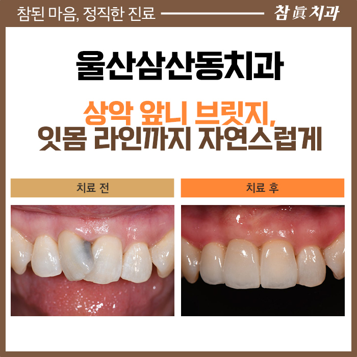 울산삼산동치과