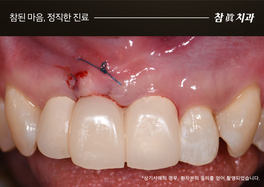 울산삼산동치과